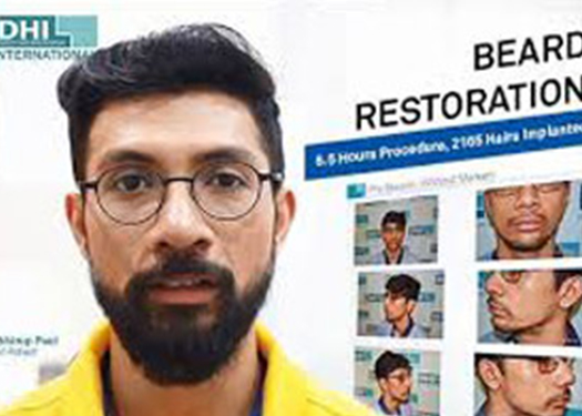 Beard Restoration Klinik Farmanina