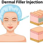 Manfaat dermal filler untuk wajah