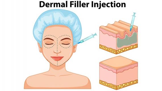 Manfaat dermal filler untuk wajah