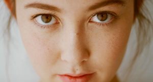 Gejala, Penyebab Jerawat, Serta Cara Pencegahannya