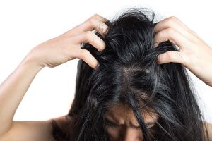 Rambut Ketombe Basah, Penyebab dan Cara Mengatasi