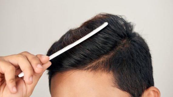 Manfaat Vitamin Rambut yang Tidak Boleh Dianggap Remeh