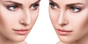 Prosedur Operasi Plastik Pada Hidung Dilakukan Kedokteran