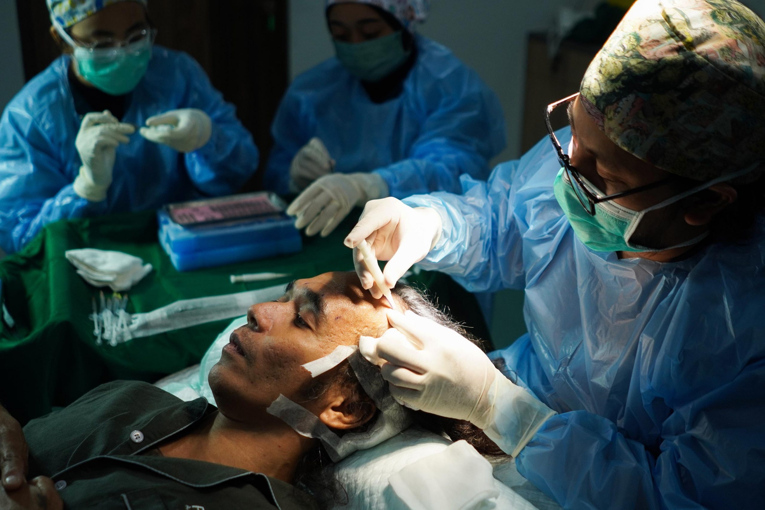 Tindakan transplasi rambut kaka slank