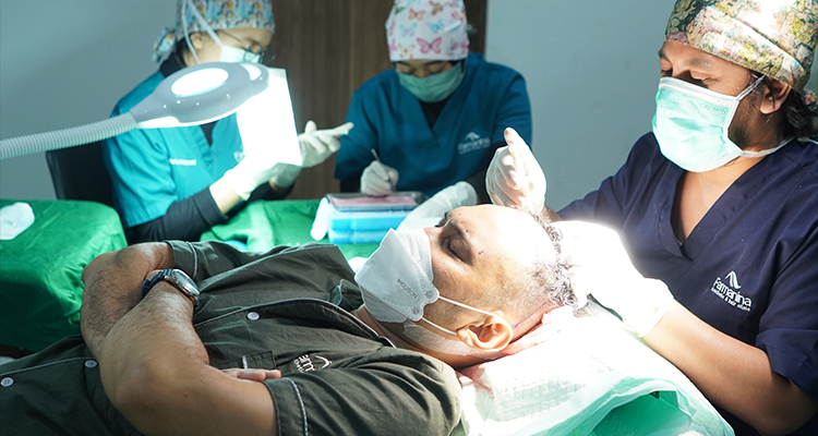 Caesar Gunawan Transplantasi Rambut