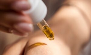 Alasan Kesehatan Skin Barrier Perlu Dijaga dengan Baik