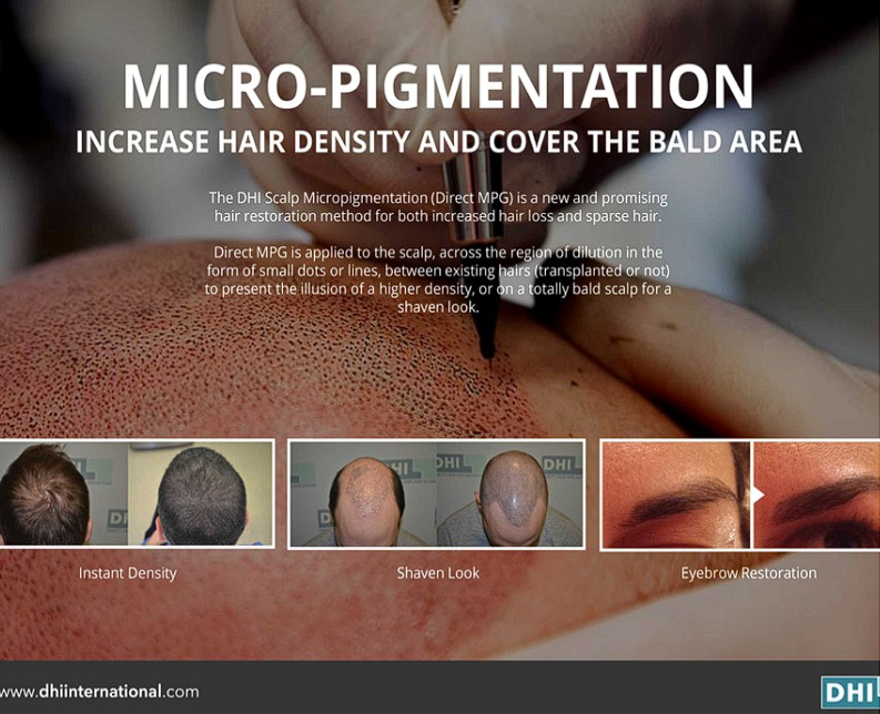 Micro Pigmentation