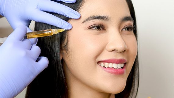 9 Manfaat PRP Treatment untuk Kesehatan dan Kecantikan Kulit