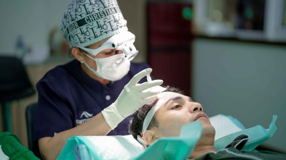 Proses Tanam Rambut: Panduan Lengkap untuk Calon Pasien