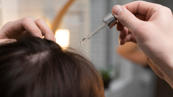 Rambut Rontok? Ini Dia Cara Mencegahnya dengan Mudah