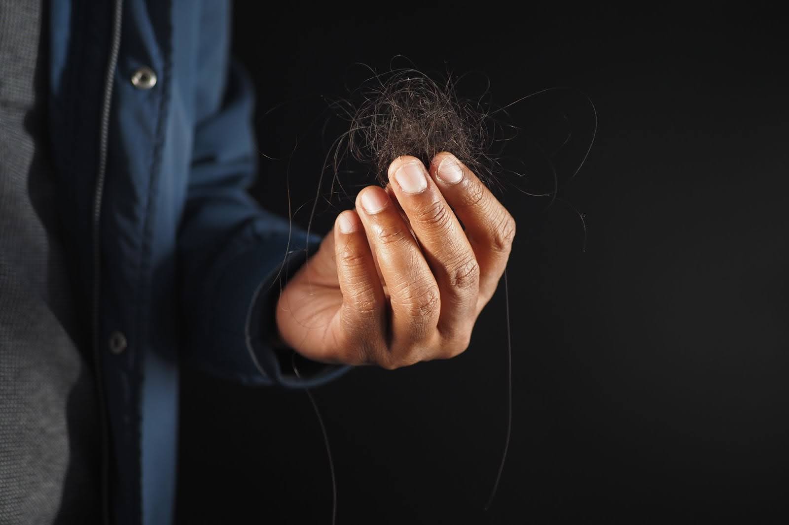 penyebab rambut rontok parah pada pria