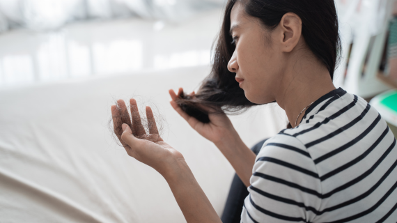 Kenali Ciri-Ciri Kebotakan Dini dan Solusi Mengatasinya