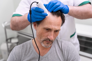 Tips Perawatan Rambut Pasca Hair Transplant