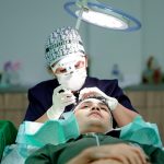 Berkenalan Dengan Metode Transplantasi Rambut dan Kelebihannya