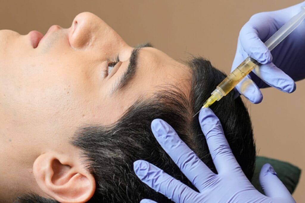 manfaat PRP treatment