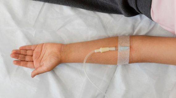 Mengenal Apa itu Infus Kromosom dan Manfaatnya bagi Kulit
