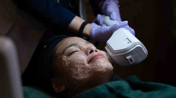 Manfaat Laser Wajah untuk Perawatan Kulit