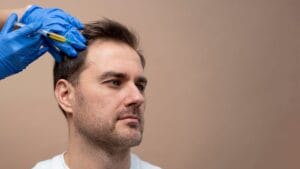 graft rambut