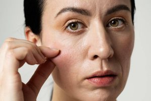 Rekomendasi Treatment Terbaik untuk Atasi Kulit Kendur dan Tidak Elastis