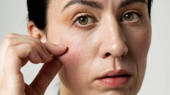 Rekomendasi Treatment Terbaik untuk Atasi Kulit Kendur dan Tidak Elastis