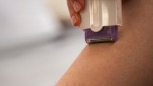laser hair removal vs shaving