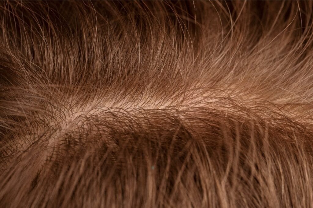 pertumbuhan rambut lambat