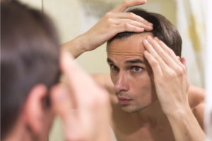 Transplantasi Rambut Gagal? Ini Penyebab dan Pantangan yang Harus Diperhatikan