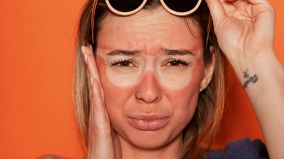 Warna Kulit Tidak Merata Pada Wajah? Atasi Dengan Cara Efektif Ini!