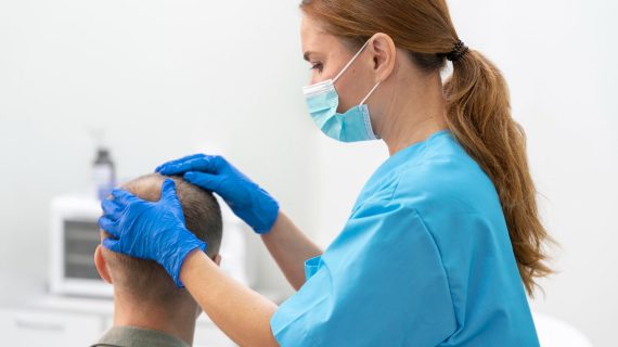Apa Metode Transplantasi Rambut Terbaik? Yuk Kenali Metode DHI!