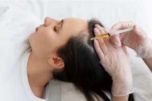 pantangan setelah prp rambut