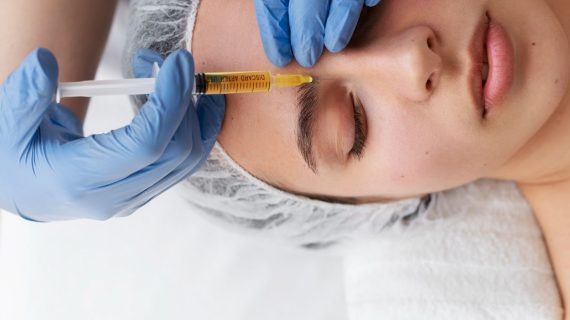 Platelet Rich Plasma adalah Perawatan Kulit Modern untuk Hasil Maksimal