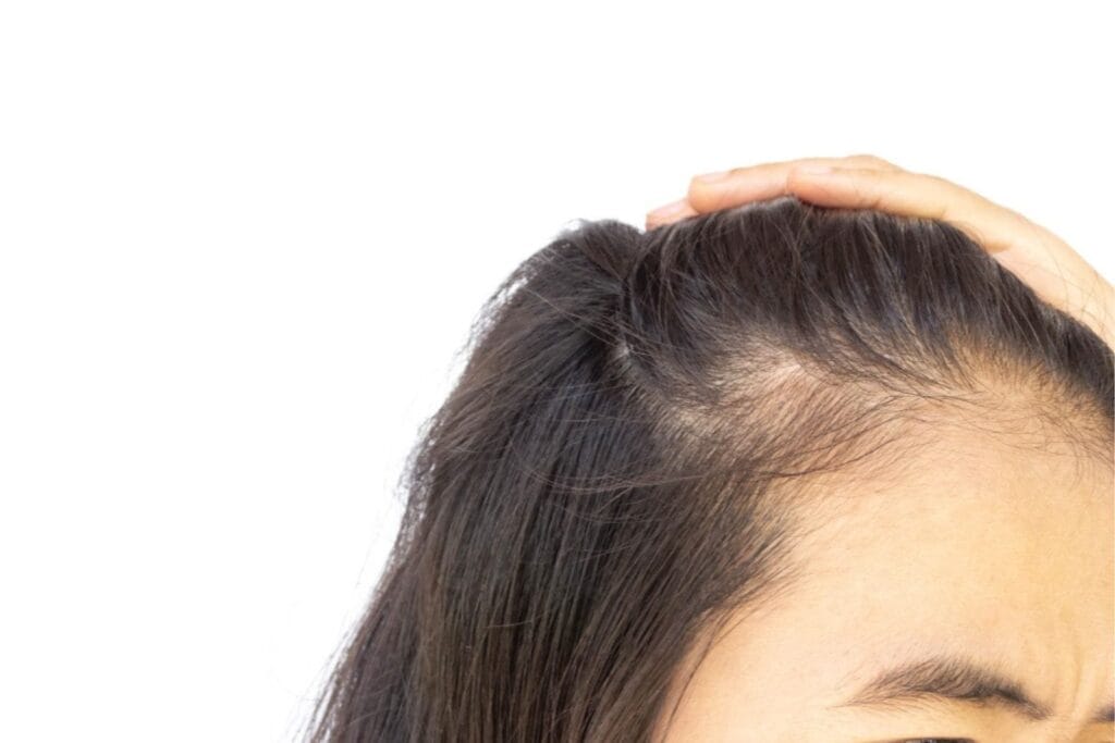 rambut pitak wanita
