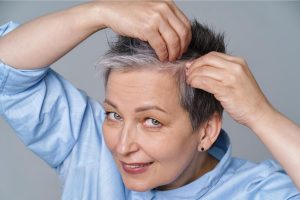 Tanam Rambut Usia Lanjut: Solusi Atasi Kebotakan dengan Hasil Alami