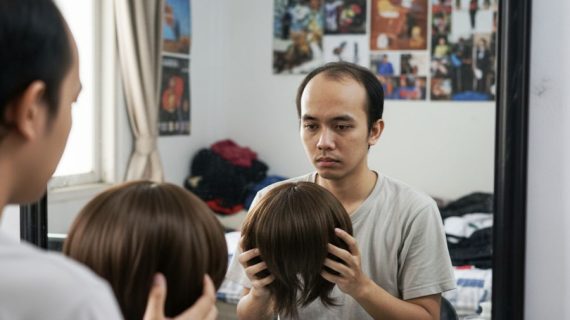 Kepala Botak di Usia Muda, Normal atau Tanda Masalah Serius?