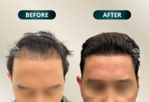 before-after3