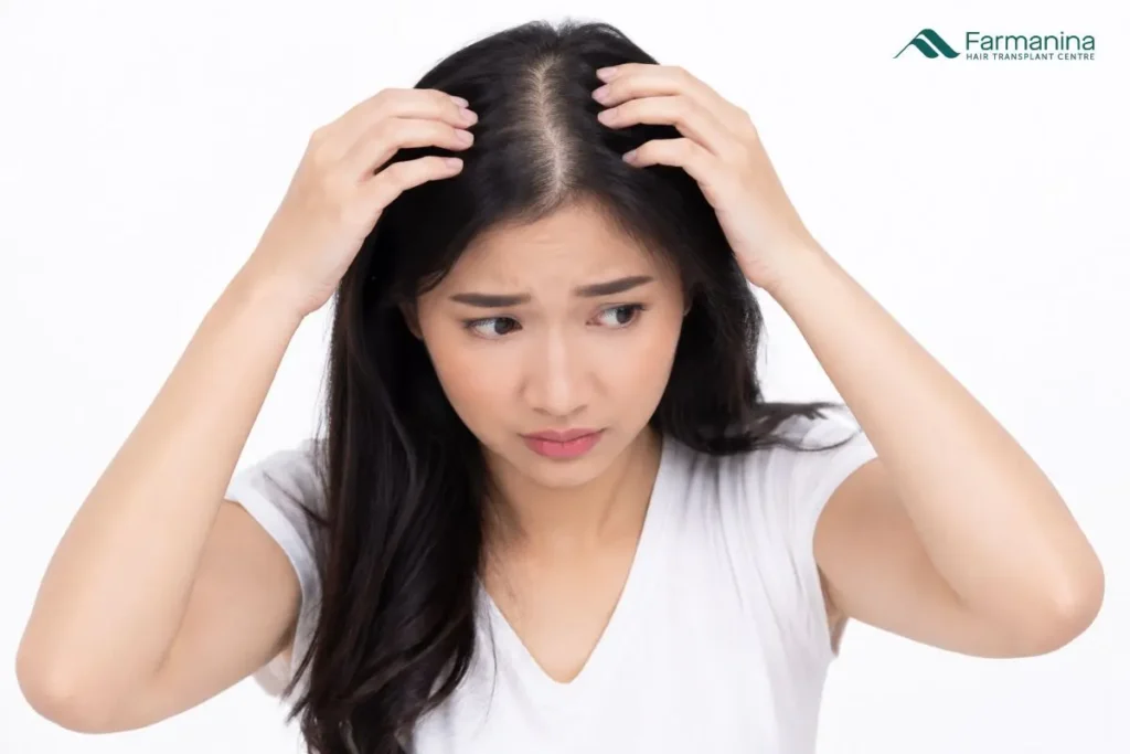 Wanita dengan rambut botak