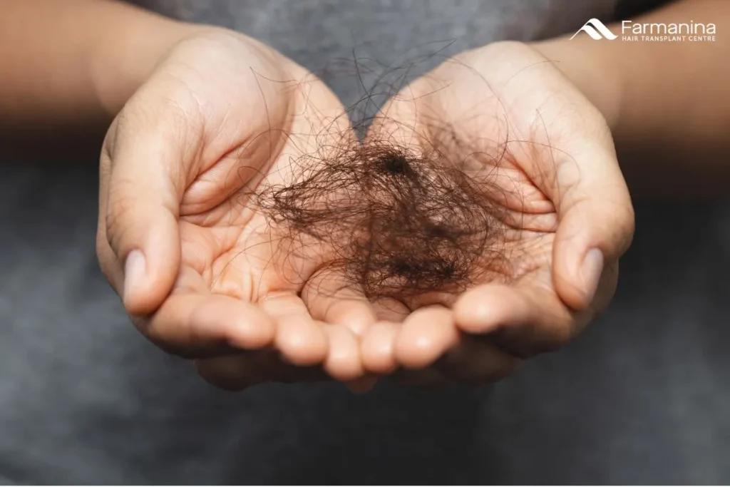 Gumpalan rambut rontok