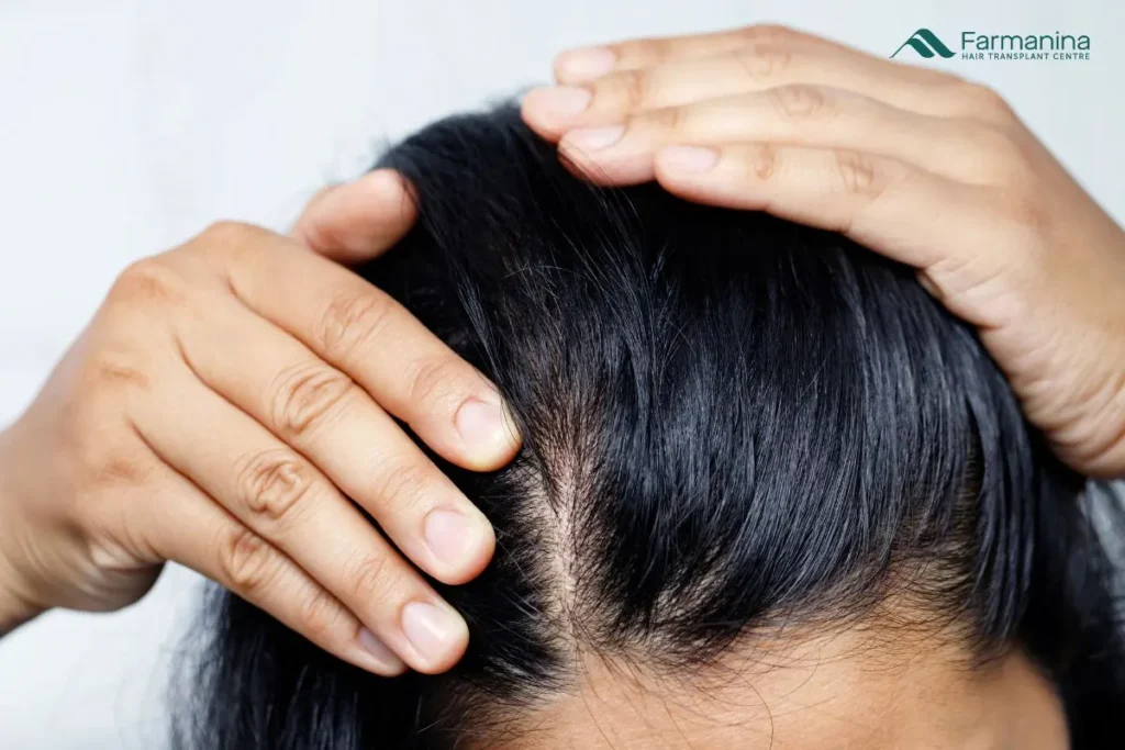 Belahan rambut wanita yang melebar