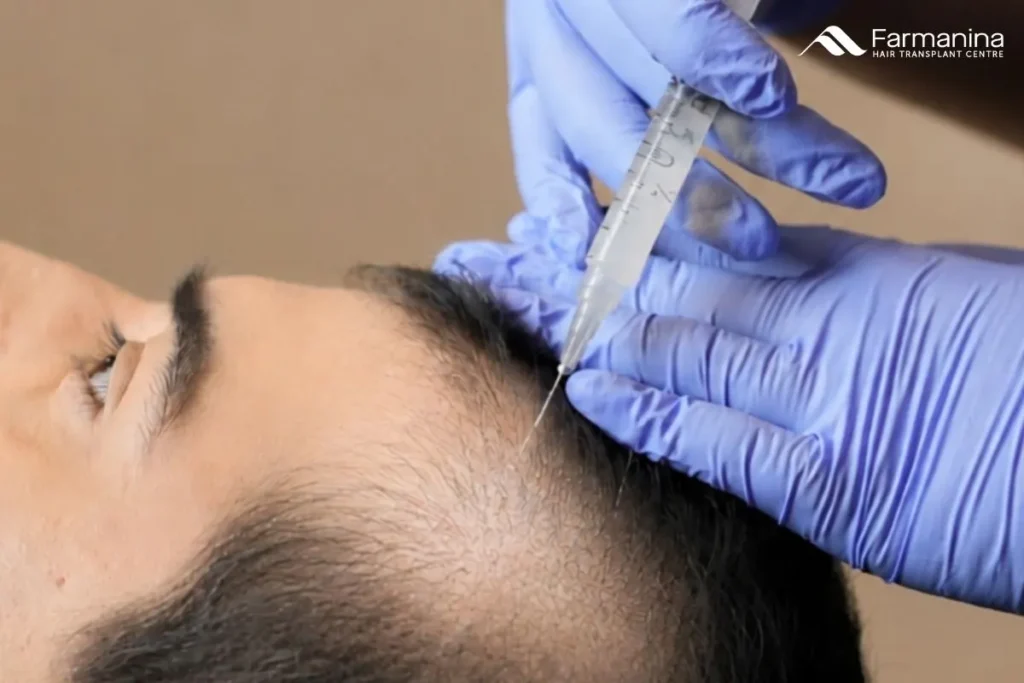 Perawatan rambut rontok dan botak di Farmanina Clinic