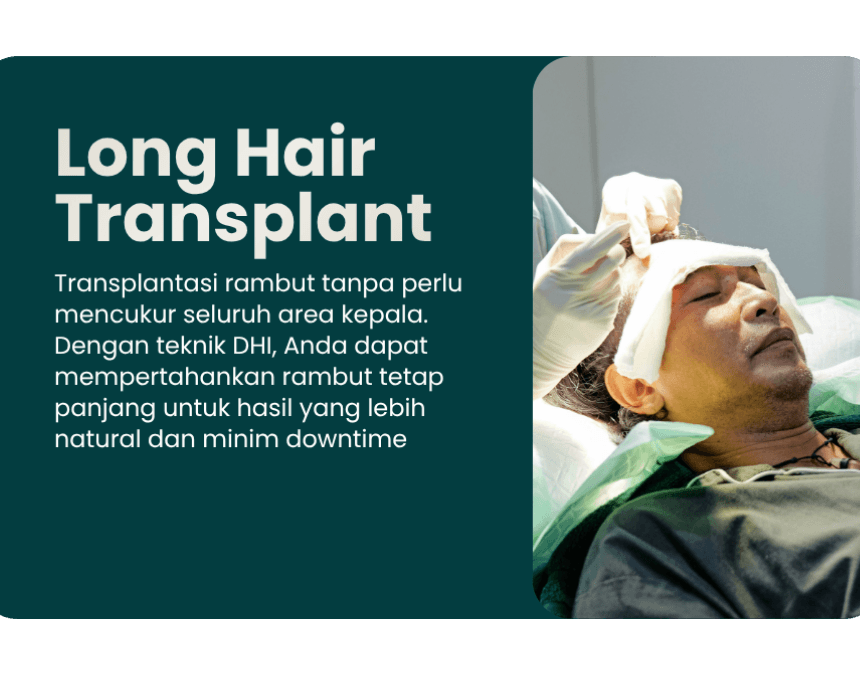 Tindakan Long Hair Transplant tanpa cukur di Farmanina Hair Clinic