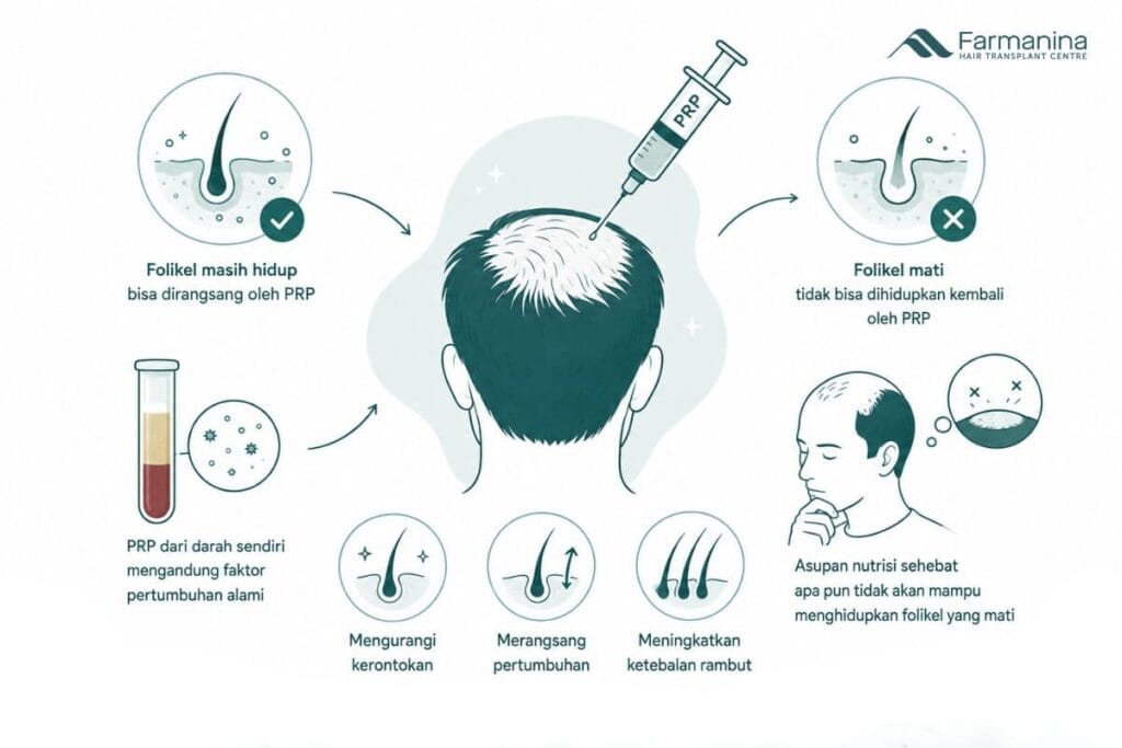 Alasan PRP rambut gagal
