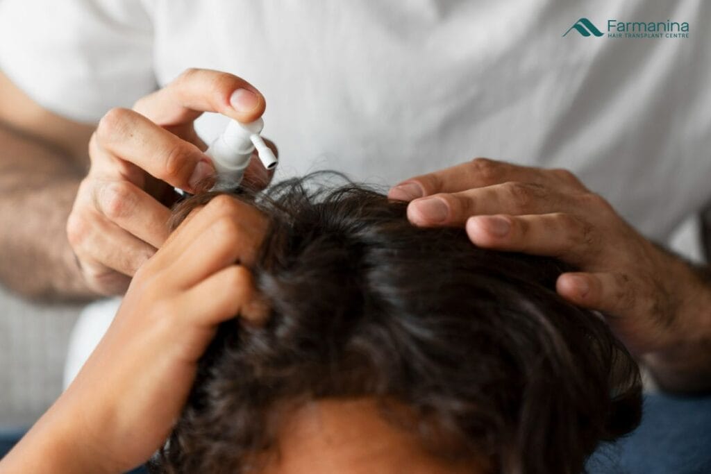 Seseorang sedang menggunakan minoxidil
