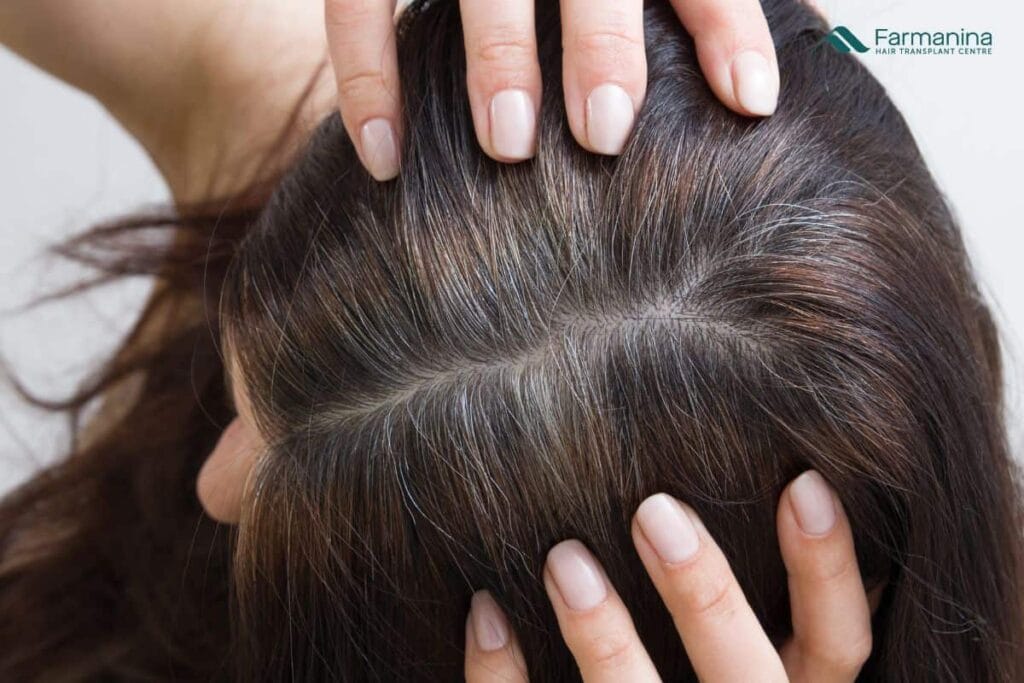 Wanita dengan rambut beruban