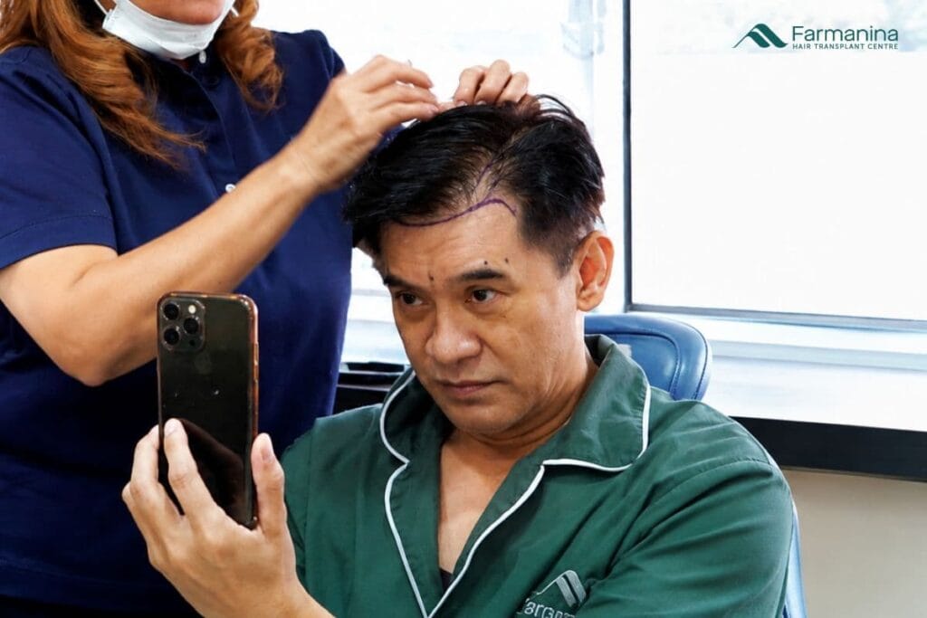 Pria dengan rambut botak dan menipis