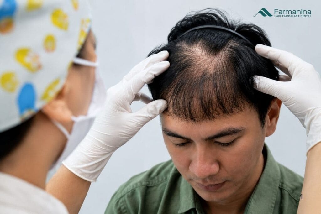 Pria dengan rambut yang rontok dan menipis