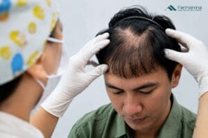 Pria dengan rambut yang rontok dan menipis