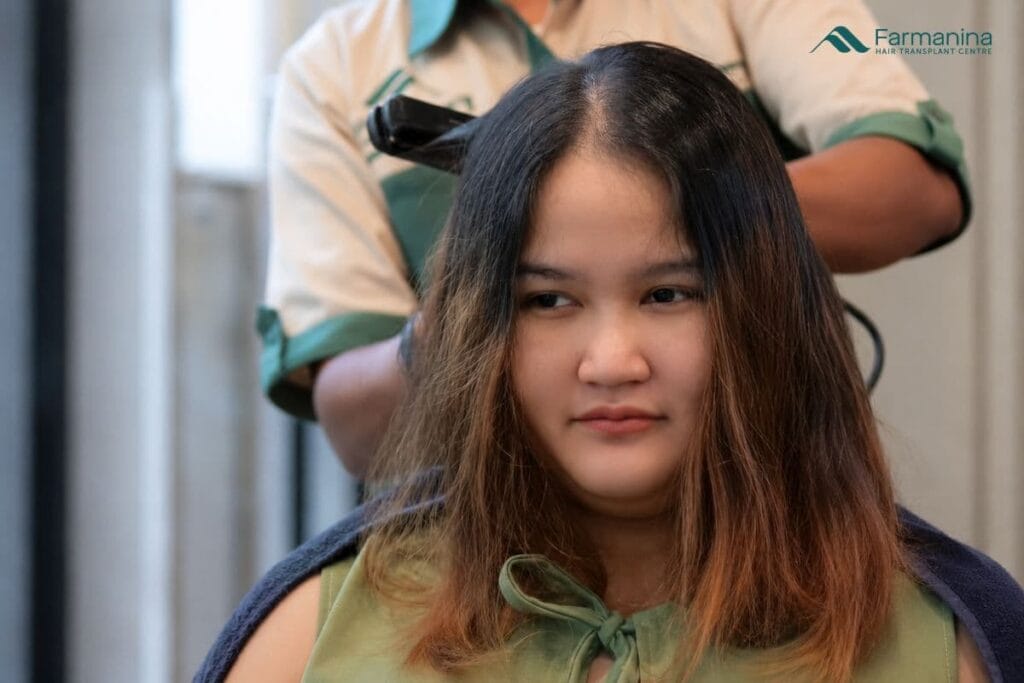 Rambut rontok menipis