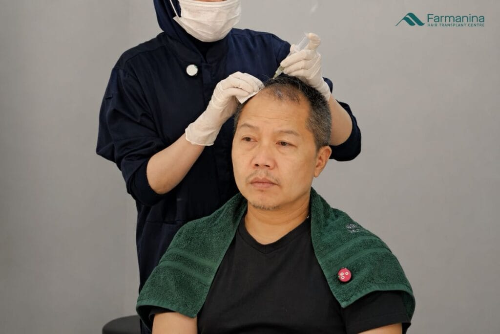 Tindakan PRP di Farmanina Clinic