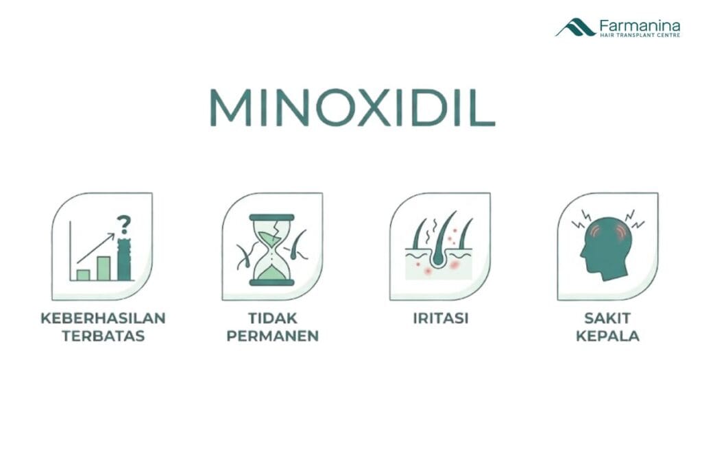 Kekurangan Minoxidil