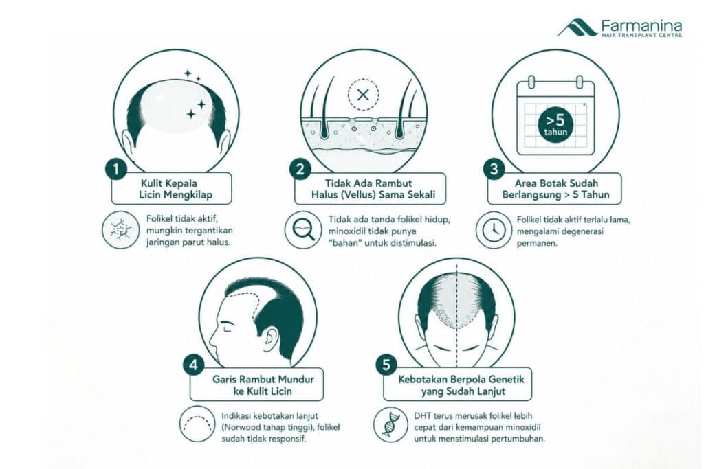 Kondisi ketika minoxidil tidak bekerja